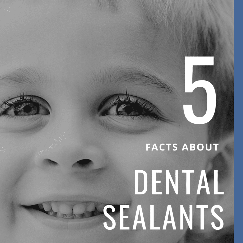5 Facts About Dental Sealants
